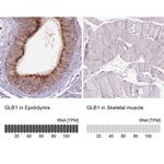 GLB1 Antibody in Immunohistochemistry (IHC)