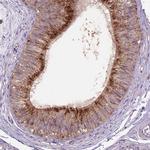 GLB1 Antibody in Immunohistochemistry (IHC)
