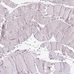 GLB1 Antibody in Immunohistochemistry (IHC)