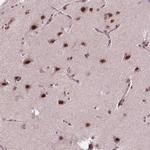 EAF1 Polyclonal Antibody