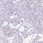 DCC Polyclonal Antibody