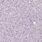 CEACAM7 Antibody in Immunohistochemistry (Paraffin) (IHC (P))