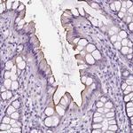 CEACAM7 Polyclonal Antibody