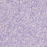 CEACAM7 Antibody in Immunohistochemistry (Paraffin) (IHC (P))