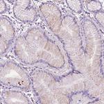 CEACAM7 Antibody in Immunohistochemistry (Paraffin) (IHC (P))