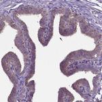 FAM114A1 Antibody in Immunohistochemistry (Paraffin) (IHC (P))