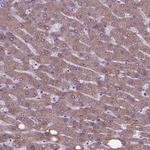 FAM114A1 Antibody in Immunohistochemistry (Paraffin) (IHC (P))