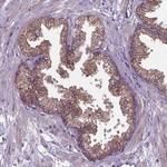 FAM114A1 Antibody in Immunohistochemistry (Paraffin) (IHC (P))