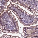 FAM114A1 Antibody in Immunohistochemistry (Paraffin) (IHC (P))
