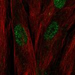 C17orf107 Polyclonal Antibody