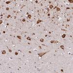 FAM116A Polyclonal Antibody