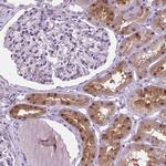 ASPG Antibody in Immunohistochemistry (IHC)