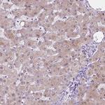 ASPG Antibody in Immunohistochemistry (IHC)