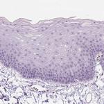 ZMAT4 Antibody in Immunohistochemistry (Paraffin) (IHC (P))