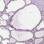 ZMAT4 Antibody in Immunohistochemistry (Paraffin) (IHC (P))