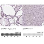 ZMAT4 Antibody in Immunohistochemistry (IHC)