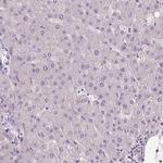 ZMAT4 Antibody in Immunohistochemistry (IHC)