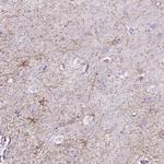 DMWD Polyclonal Antibody