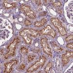 ARL5C Antibody in Immunohistochemistry (Paraffin) (IHC (P))