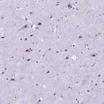 FAM124B Antibody in Immunohistochemistry (Paraffin) (IHC (P))