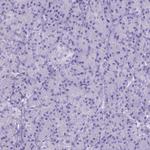 FAM124B Antibody in Immunohistochemistry (Paraffin) (IHC (P))