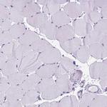 FAM124B Antibody in Immunohistochemistry (Paraffin) (IHC (P))