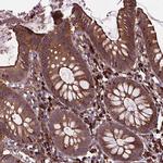 MYH14 Polyclonal Antibody