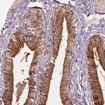 VARS2 Polyclonal Antibody