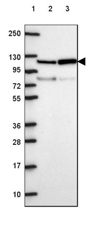 VARS2 Antibody in Western Blot (WB)