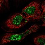 PHF7 Polyclonal Antibody