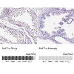 PHF7 Antibody