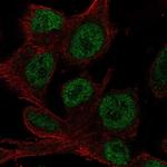 HOXD4 Polyclonal Antibody