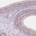 HOXD4 Antibody in Immunohistochemistry (IHC)
