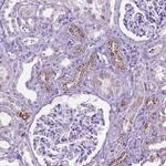 TMEM132E Antibody in Immunohistochemistry (Paraffin) (IHC (P))