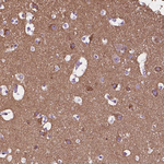 TMEM132E Polyclonal Antibody