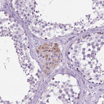 TMEM132E Antibody in Immunohistochemistry (Paraffin) (IHC (P))