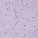 TMEM132E Antibody in Immunohistochemistry (Paraffin) (IHC (P))