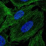 SPECC1L Polyclonal Antibody