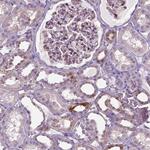 SPECC1L Antibody in Immunohistochemistry (Paraffin) (IHC (P))