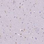 TMEM169 Polyclonal Antibody