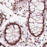 ELF2 Antibody in Immunohistochemistry (IHC)
