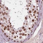 ELF2 Antibody in Immunohistochemistry (IHC)