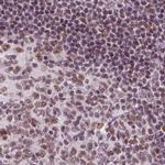 ELF2 Antibody in Immunohistochemistry (IHC)