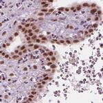 ELF2 Antibody in Immunohistochemistry (IHC)