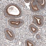 LZTR1 Antibody in Immunohistochemistry (Paraffin) (IHC (P))