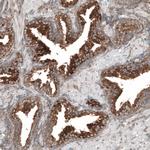 LZTR1 Antibody in Immunohistochemistry (Paraffin) (IHC (P))