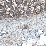 LZTR1 Polyclonal Antibody