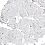 LZTR1 Antibody in Immunohistochemistry (Paraffin) (IHC (P))