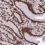 SMIM5 Polyclonal Antibody