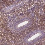 LRRC3C Polyclonal Antibody